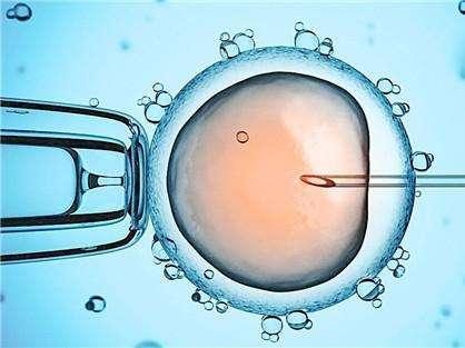 体外受精 IVF-ET
